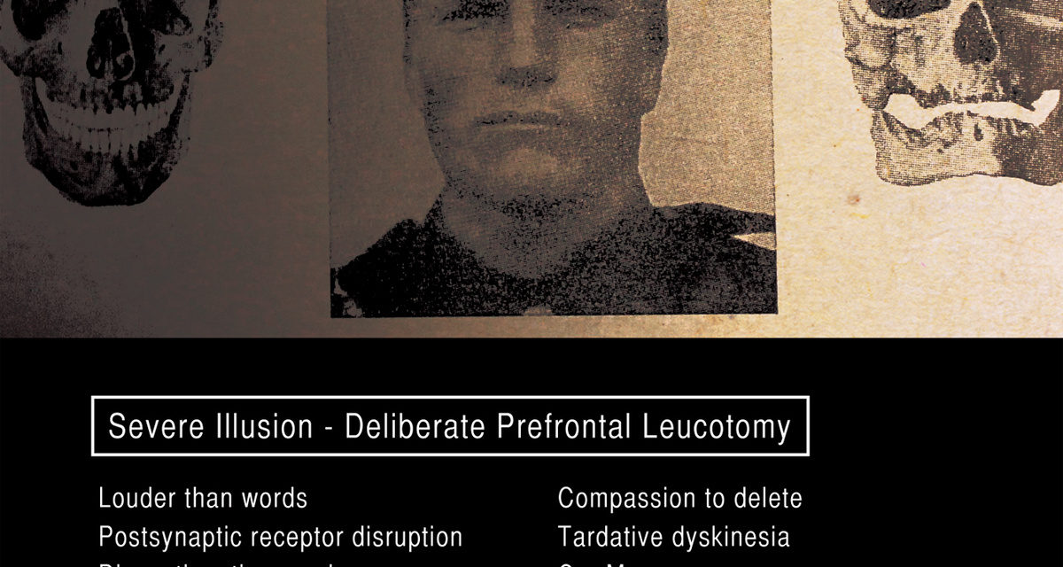 Severe Illusion, “Deliberate Prefontal Leucotomy”